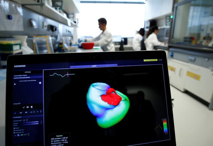 Tech breakthrough offers early warning system for heart attacks