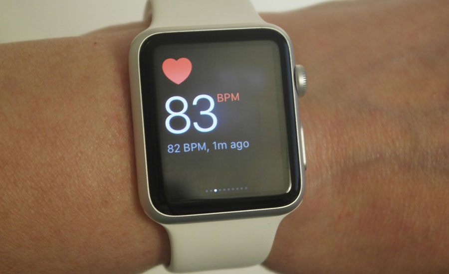 Apple Watch detects irregular heart beat in large US study