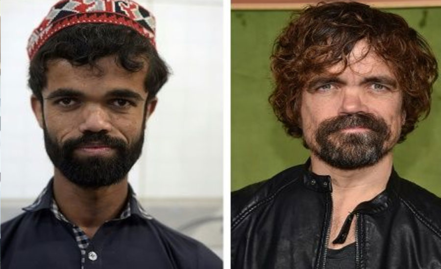 Pakistani Rozi Khan famed for uncanny resemblance to Tyrion Lannister