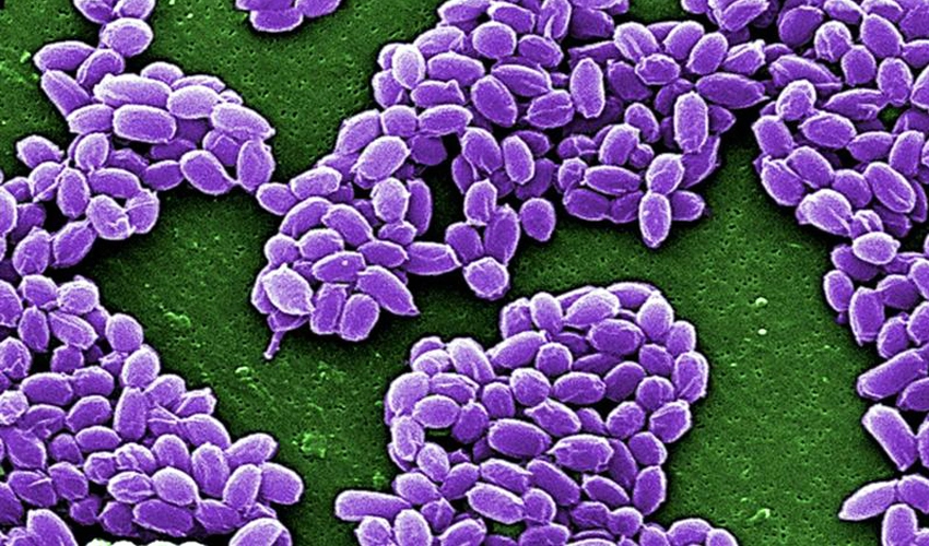 Anthrax outbreak in Uganda kills 17 in November